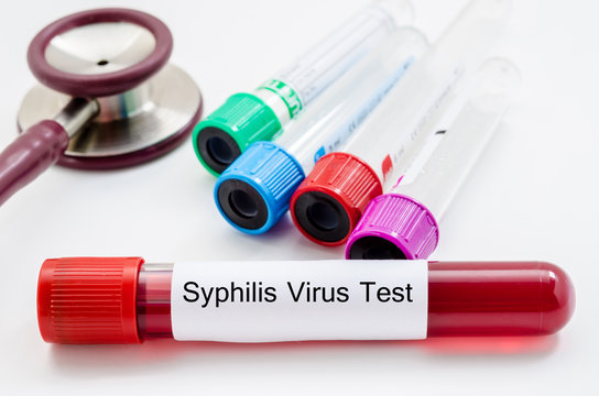 Syphilis virus blood sample collection tube.