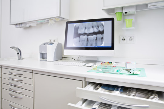 Drawer with dental instruments and x-ray image of teeth