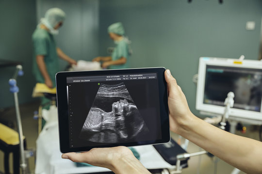 Hands holding a digital tablet showing an ultrasound image of a fetus in surgery room
