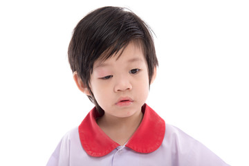 Cute asian child with a swollen eyelid on white background isolated