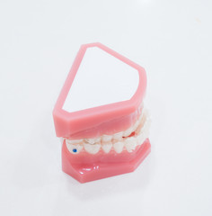 denture
