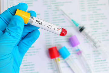 Naklejka premium PSA positive blood sample