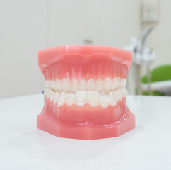 denture
