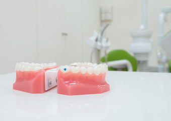 Fototapeta na wymiar denture