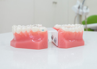 denture
