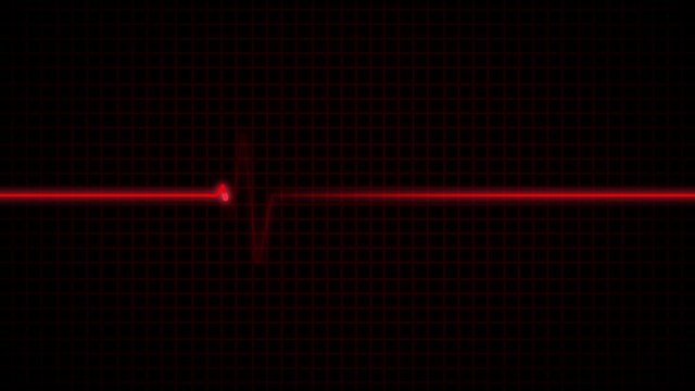 Egk / Kalp Ritmi / &Ouml;l&uuml;m