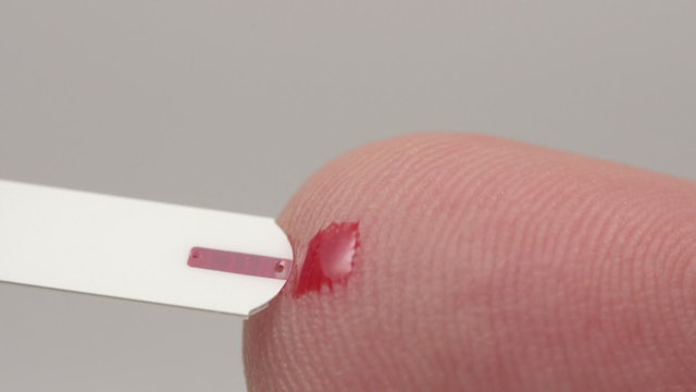 Macro video of self testing for diabetes. The blood sample is being taken by a stick.
