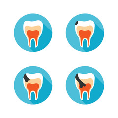 Set icons with flat design elements of tooth decay disease. Stages of tooth decay on white background. Modern vector pictogram collection concept - stock vector