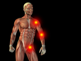 Fototapeta na wymiar Conceptual human body anatomy pain on black
