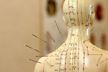 Akupunktur als Alternativmedizin - obrazy, fototapety, plakaty