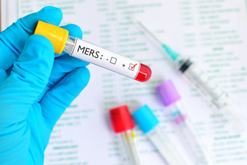 Naklejka premium MERS virus positive