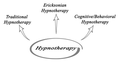 Diagram of Hypnotherapy