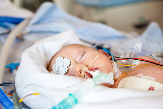 Infant boy sedated in intensive care unit after heart surgery. 
