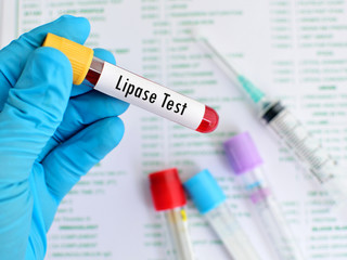 Blood sample for lipase enzyme test, pancreatitis diagnosis