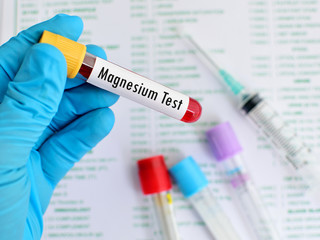 Blood sample for magnesium (Mg) test