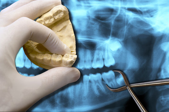 dentist hand show molar teeth