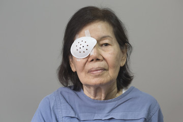 Eye shield covering after cataract surgery. - obrazy, fototapety, plakaty