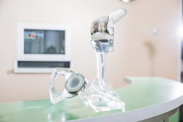 a transparent plastic mockup of the bones and joints of the legs and the bones of the pelvis is in a medical office
