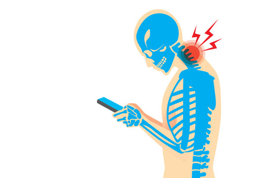 Neck Bone And Muscles Have Pain Because Smartphone Addiction And Play Long Time.