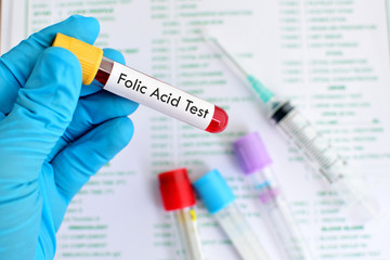 Folic acid test
