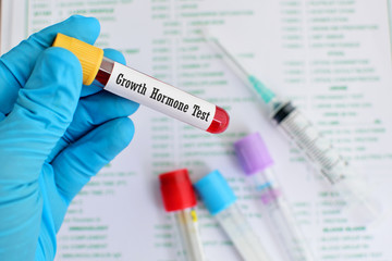 Growth hormone test