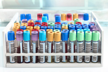 blood tubes in tray in the lab / blood tube test for analysis in the laboratory of hematology