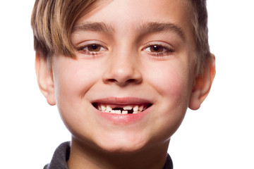Obraz premium boy portrait with a lost tooth