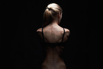Obraz na płótnie Canvas sadness young woman with naked back.sexy body girl