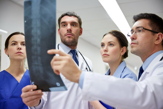 group of doctors looking at x-ray scan image