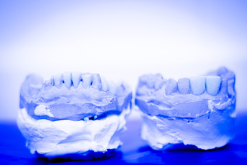 Dental prosthetics clay tooth mold