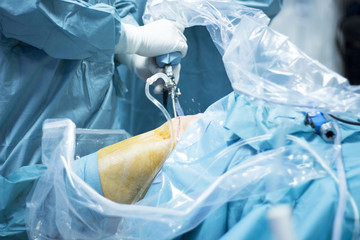 Knee arthroscopy orthopedic surgery operation - obrazy, fototapety, plakaty