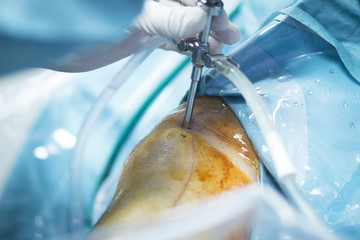 Orthopedics knee surgery hospital operation