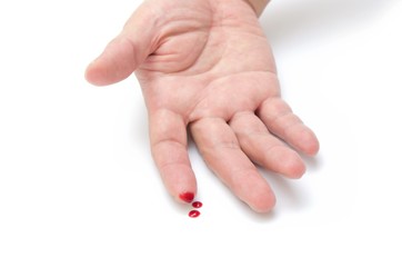 Injured finger with bleeding open cut