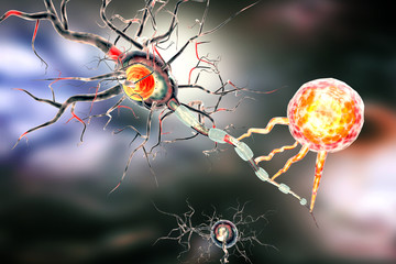 3d illustration of nerve cells, concept for Neurological Diseases, tumors and brain surgery.