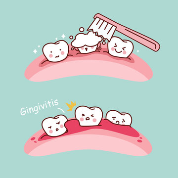 Cartoon Tooth Brush And Gingivitis