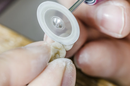 Dental technician  working with diamond discs.