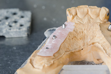 Metal structure of a dental crown or bridge