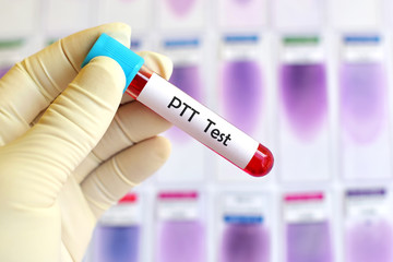 Fototapeta premium Blood sample for PTT test (Blood coagulation testing) 