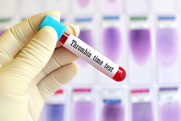 Fototapeta premium Blood sample for thrombin time test (Blood coagulation testing) 