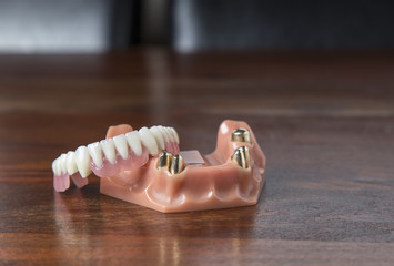 Close up of dentures with gold teeth