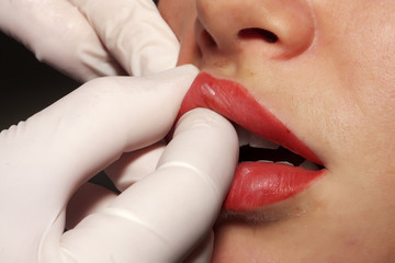 Contour plastic:  Cosmetoligist appies a lips massage after procedure of  contour plastic of lips