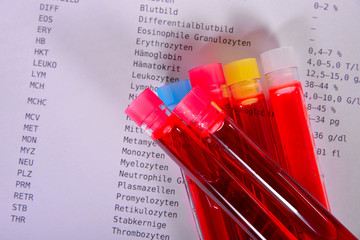 Labortest auf Virus und Krankheiten Labor Bluttest Labormedizin Virustest Corona