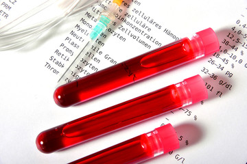 Labor Bluttest Labormedizin Blut Virus Test Impfstoff