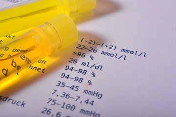 Urintest Labor Harn - Labortest auf Virus Impfstoff Forschung