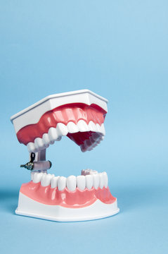 a model of the teeth - dentures