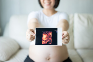 Pregnant woman with ultrasound scan picture