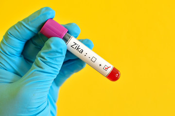 Blood sample positive with Zika virus
