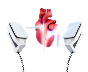 Conceptual image of the model heart and the discharge of defibri - obrazy, fototapety, plakaty