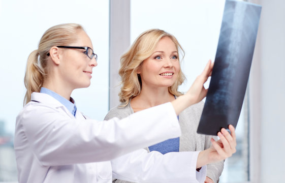 woman patient and doctor with spine x-ray scan