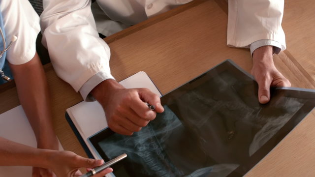 Doctors examining Xray scan